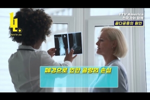 골다공증의 원인  I  김성현 내과 2부